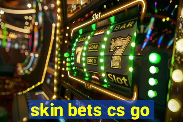 skin bets cs go