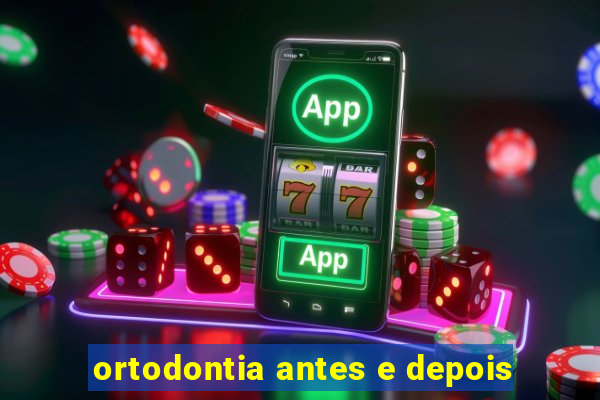 ortodontia antes e depois