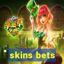 skins bets